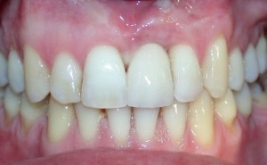 endodoncija-1 (8)